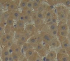 Polyclonal Antibody to Leukocyte Associated Immunoglobulin Like Receptor 2 (LAIR2)