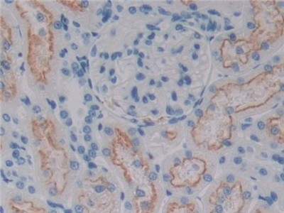 Polyclonal Antibody to Cluster Of Differentiation 320 (CD320)