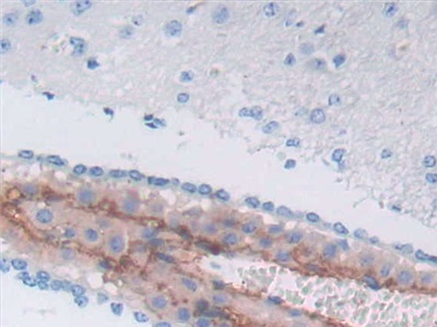 Polyclonal Antibody to Alpha-1-Antichymotrypsin (a1ACT)