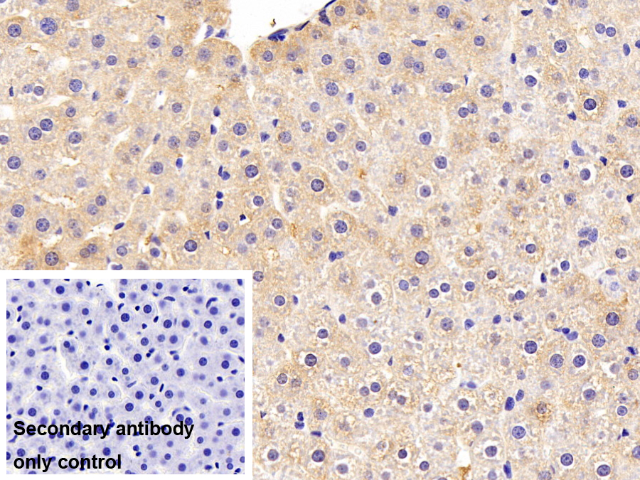 Polyclonal Antibody to Alpha-2-Macroglobulin (a2M)