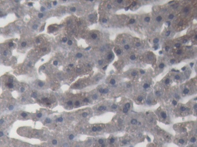 Polyclonal Antibody to Alpha-2-Macroglobulin (a2M)