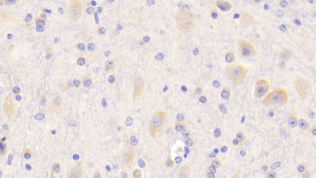 Polyclonal Antibody to Amyloid Precursor Protein (APP)