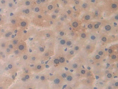 Polyclonal Antibody to Amyloid Precursor Protein (APP)