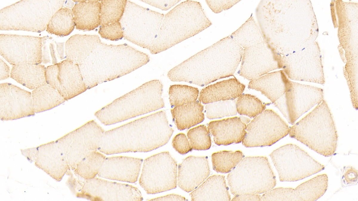 Polyclonal Antibody to Neuromedin U (NMU)