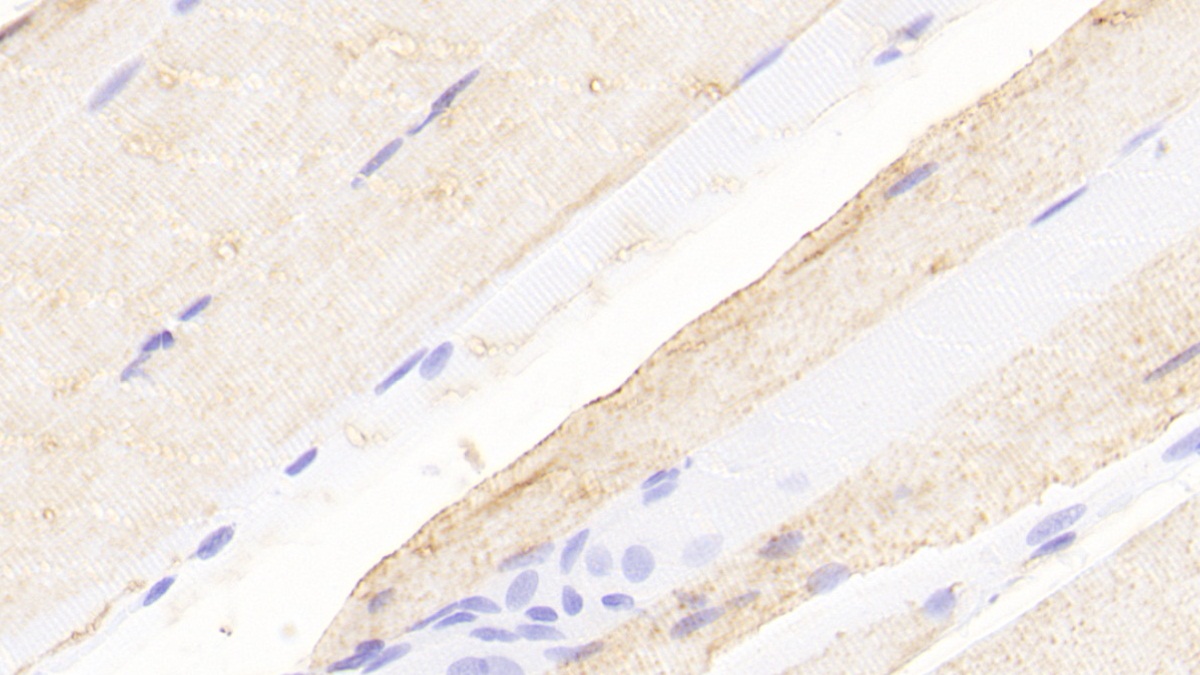 Polyclonal Antibody to Neuromedin U (NMU)