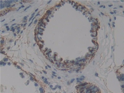 Polyclonal Antibody to Ubiquitin Activating Enzyme E1 Like Protein (UBE1L)