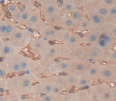 Polyclonal Antibody to Albumin (ALB)