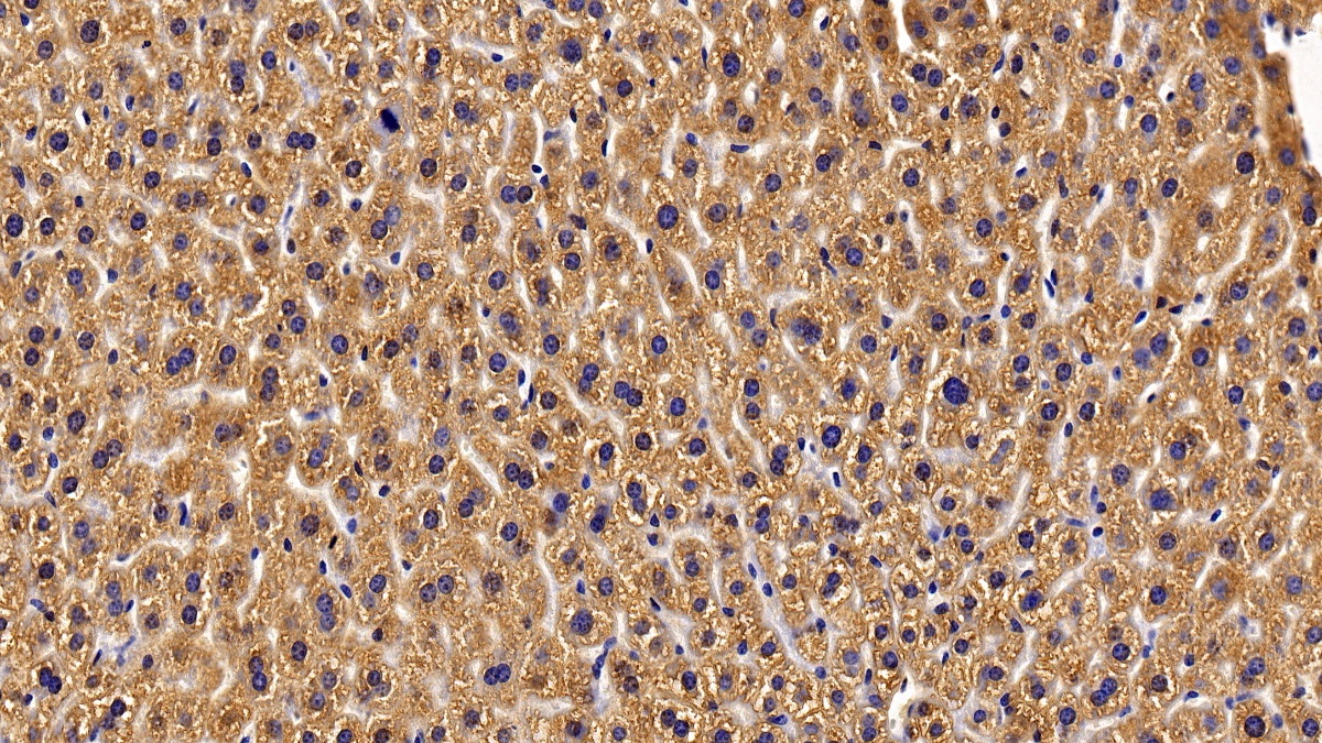 Polyclonal Antibody to Growth Hormone Receptor (GHR)