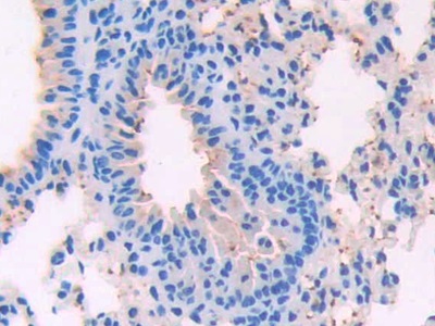 Polyclonal Antibody to Surfactant Associated Protein D (SPD)