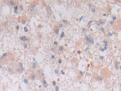 Polyclonal Antibody to Vimentin (VIM)