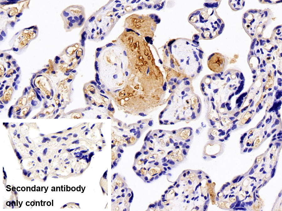 Polyclonal Antibody to Vitronectin (VTN)