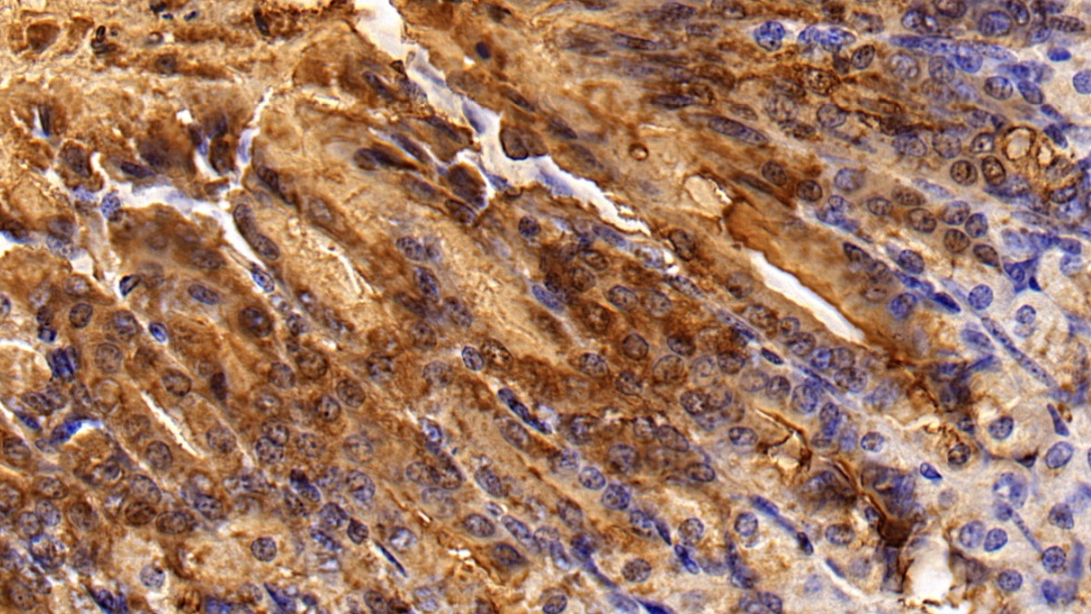 Polyclonal Antibody to Trefoil Factor 1 (TFF1)