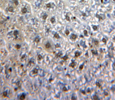 Polyclonal Antibody to Transcriptional Activator Myb (c-Myb)