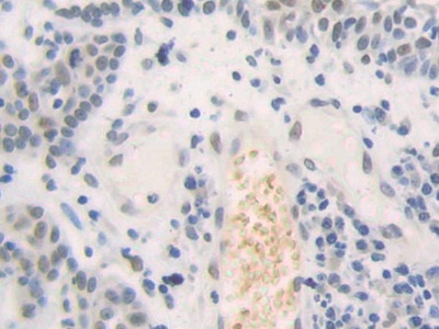 Polyclonal Antibody to High Mobility Group Nucleosome Binding Domain Containing Protein 2 (HMGN2)