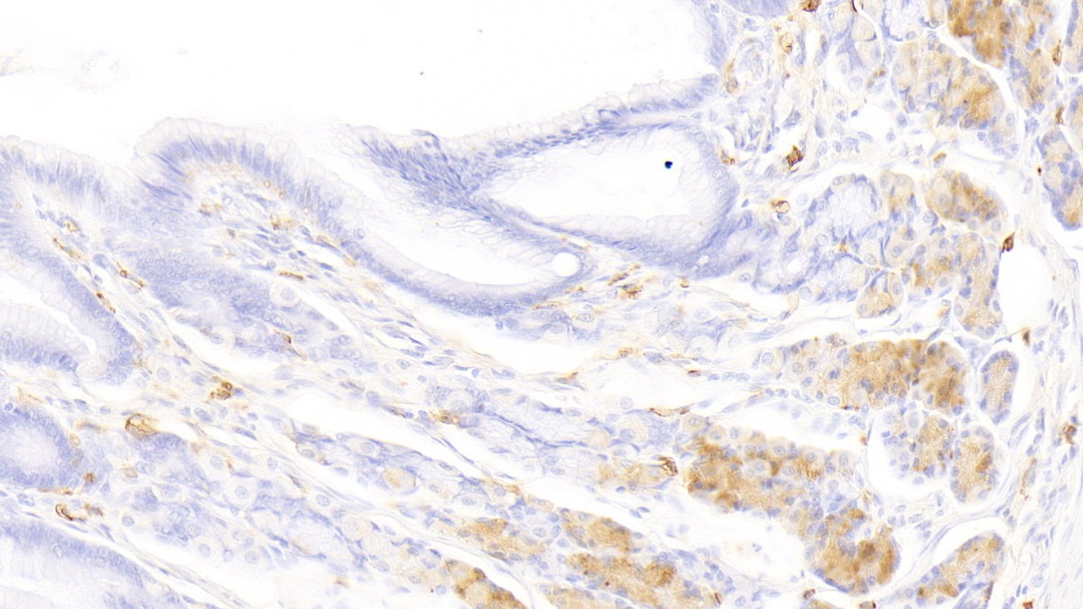 Polyclonal Antibody to Tryptase (TPS)