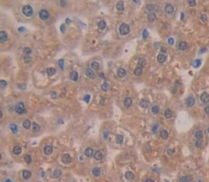 Polyclonal Antibody to Tryptase (TPS)