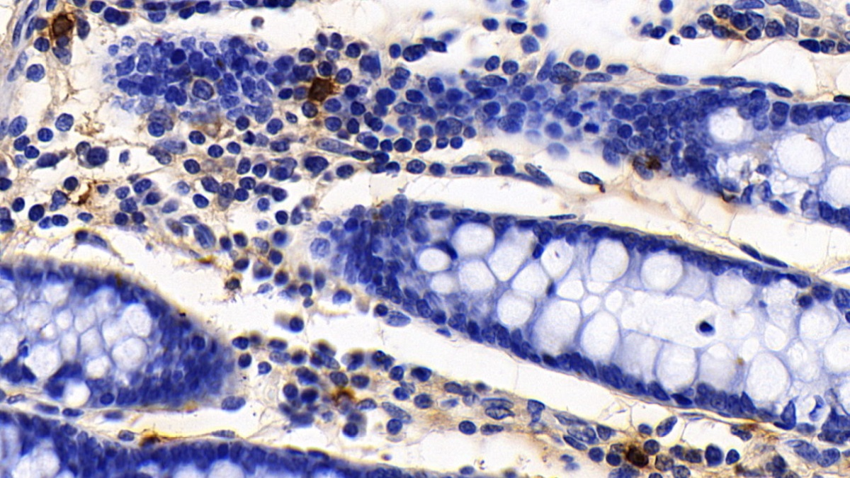 Polyclonal Antibody to Tryptase (TPS)