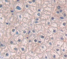 Polyclonal Antibody to Interleukin 12 Receptor Beta 2 (IL12Rb2)