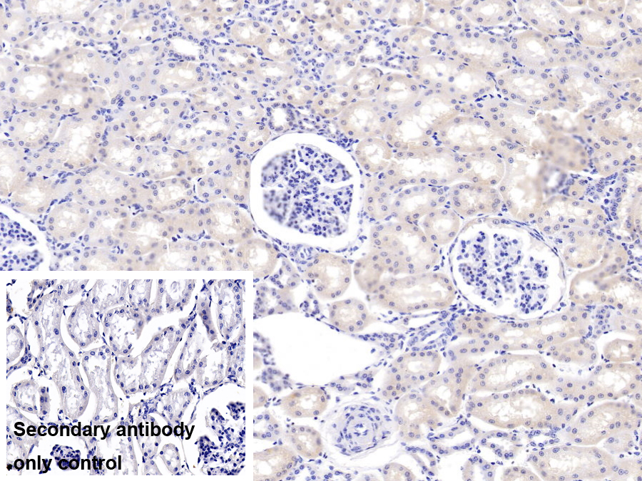 Polyclonal Antibody to Polymeric Immunoglobulin Receptor (PIGR)