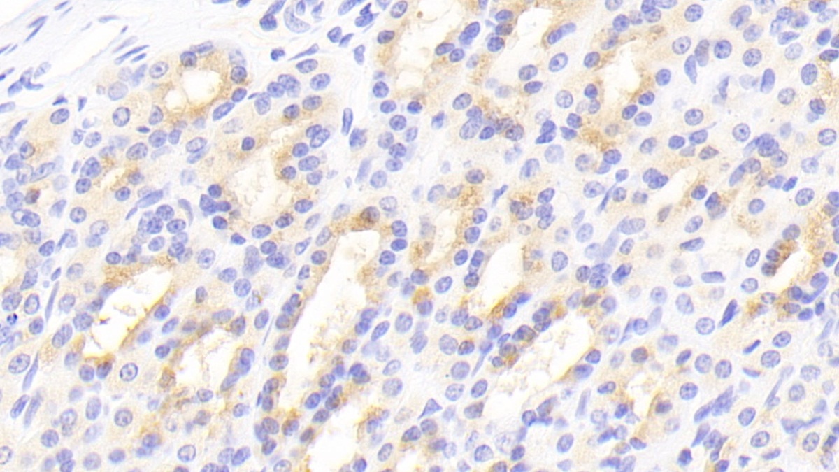 Polyclonal Antibody to Polymeric Immunoglobulin Receptor (PIGR)