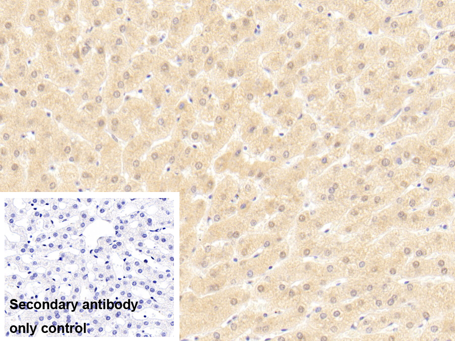 Polyclonal Antibody to General Transcription Factor IIH Subunit 1 (GTF2H1)