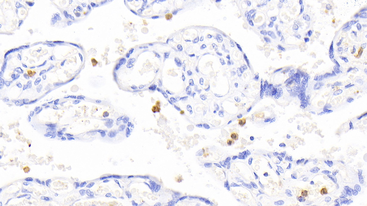 Polyclonal Antibody to S100 Calcium Binding Protein A12 (S100A12)