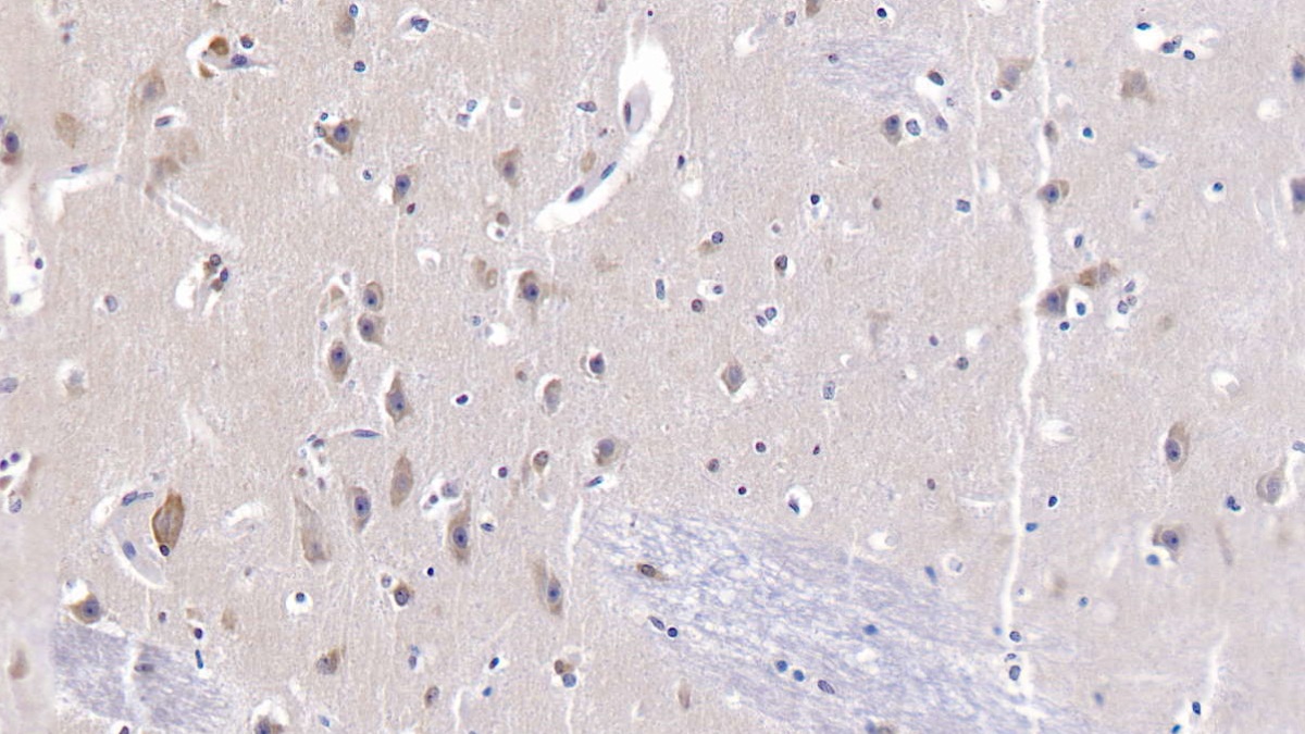 Polyclonal Antibody to Heat Shock 70kDa Protein 9 (HSPA9)