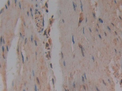 Polyclonal Antibody to Nucleoporin 37 (NUP37)