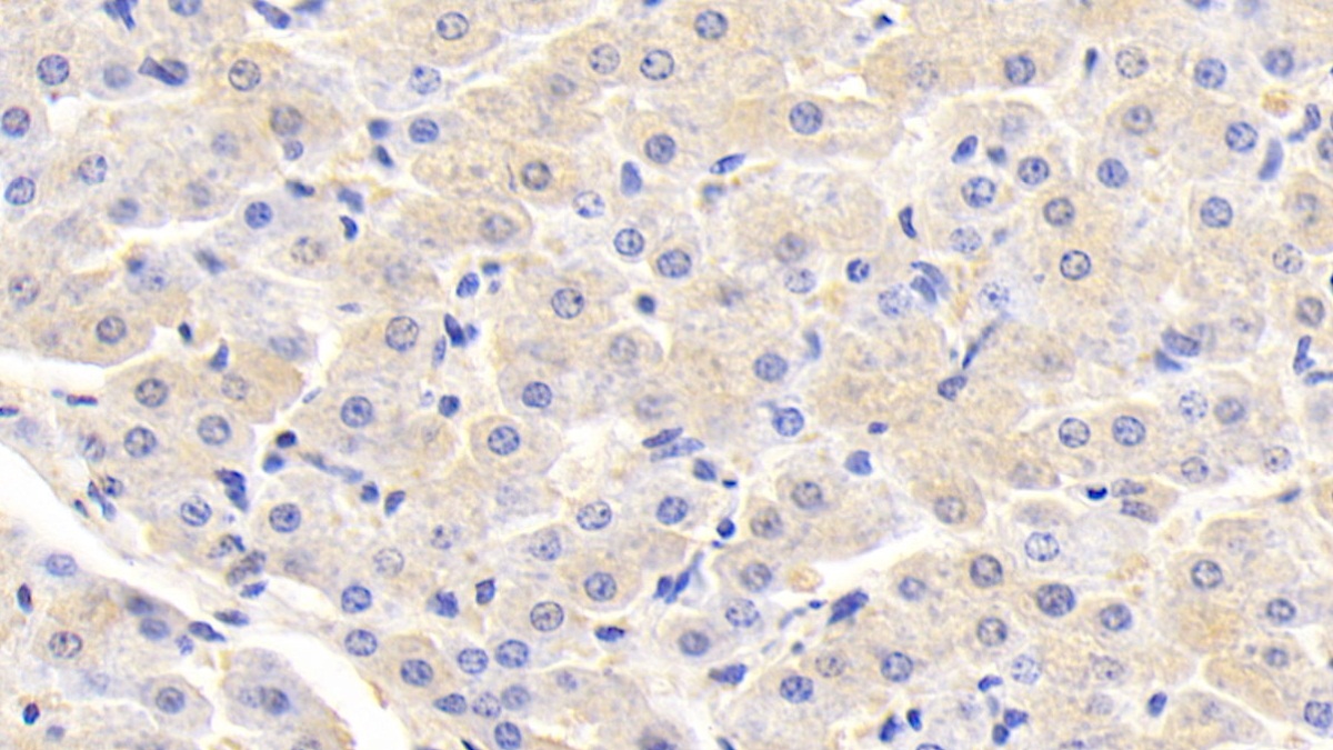 Polyclonal Antibody to Glutathione S Transferase Pi (GSTp)