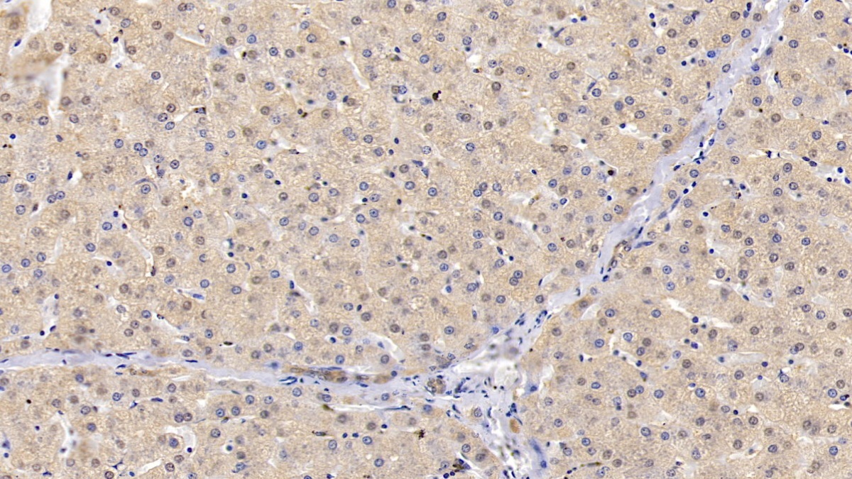 Polyclonal Antibody to Glutathione S Transferase Pi (GSTp)