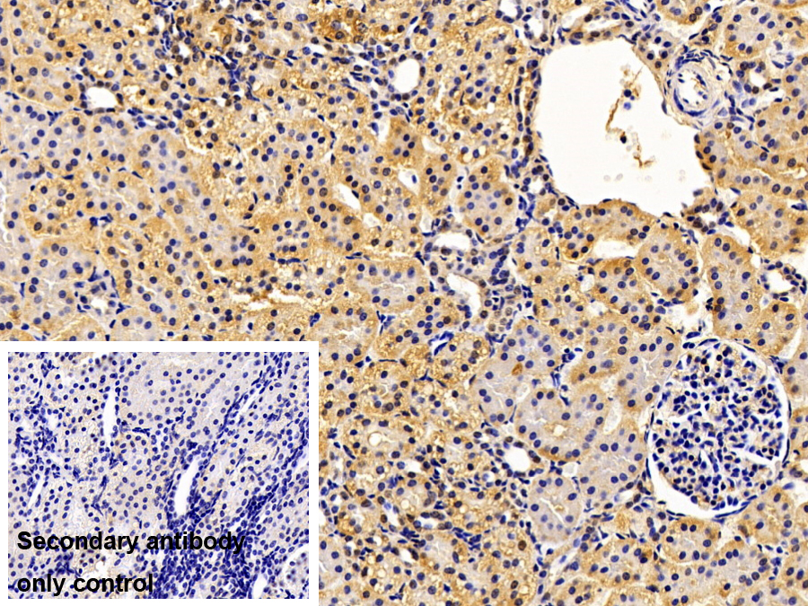 Polyclonal Antibody to Glutathione S Transferase Pi (GSTp)