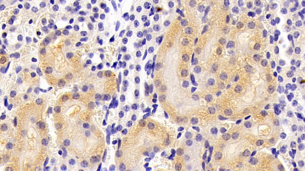 Polyclonal Antibody to Alkaline Phosphatase, Tissue-nonspecific (ALPL)