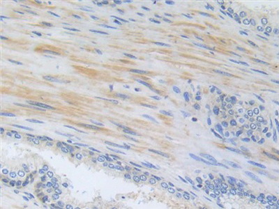 Polyclonal Antibody to Brain Finger Protein (BFP)