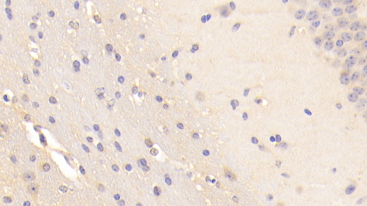 Polyclonal Antibody to Brain Finger Protein (BFP)