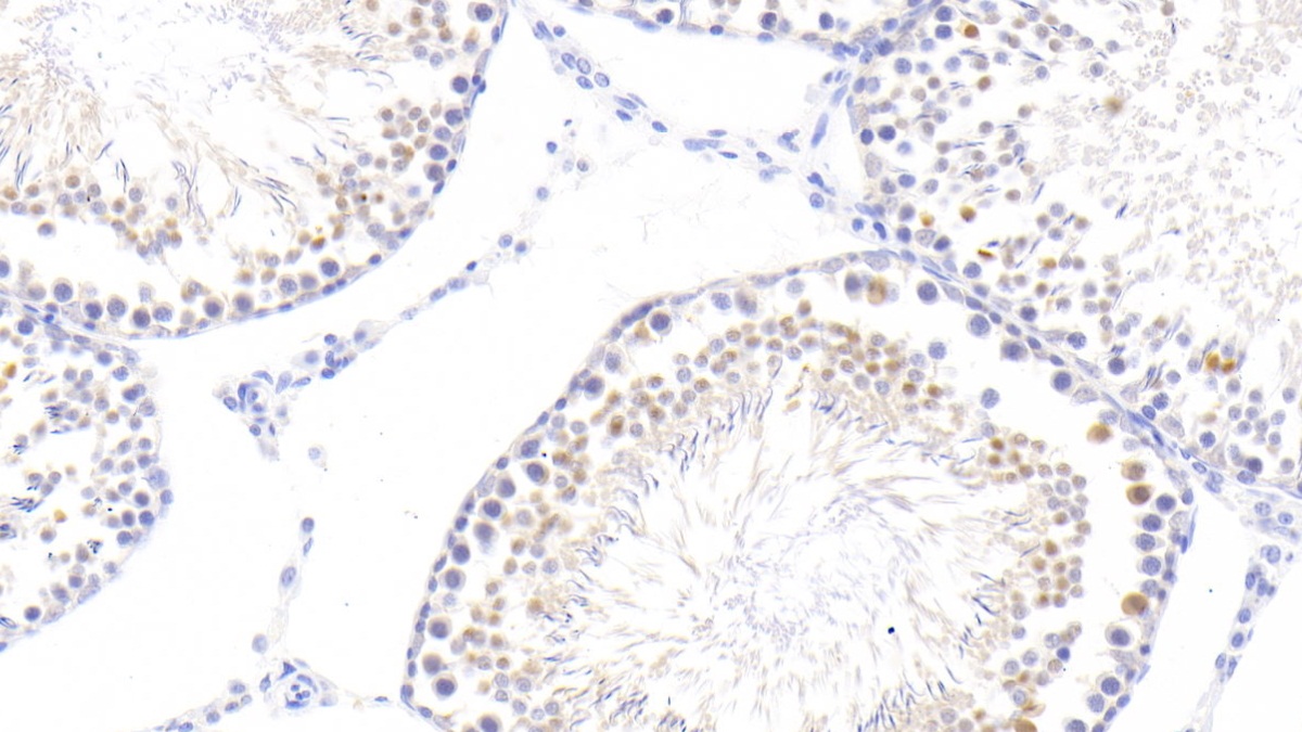 Polyclonal Antibody to Nucleoporin 50kDa (NUP50)