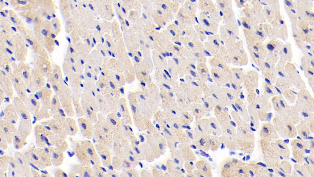 Polyclonal Antibody to Myosin Light Chain 1 (MYL1)