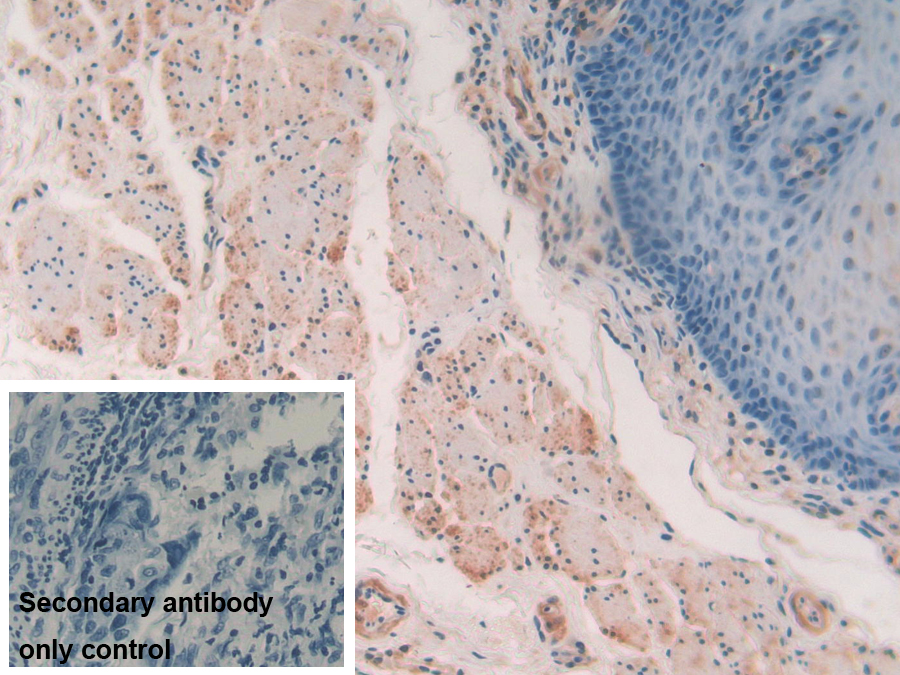 Polyclonal Antibody to Myosin Light Chain Kinase (MYLK)