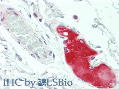 Polyclonal Antibody to Low Density Lipoprotein (LDL)