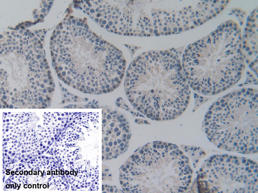 Polyclonal Antibody to Nucleoporin 85 (NUP85)