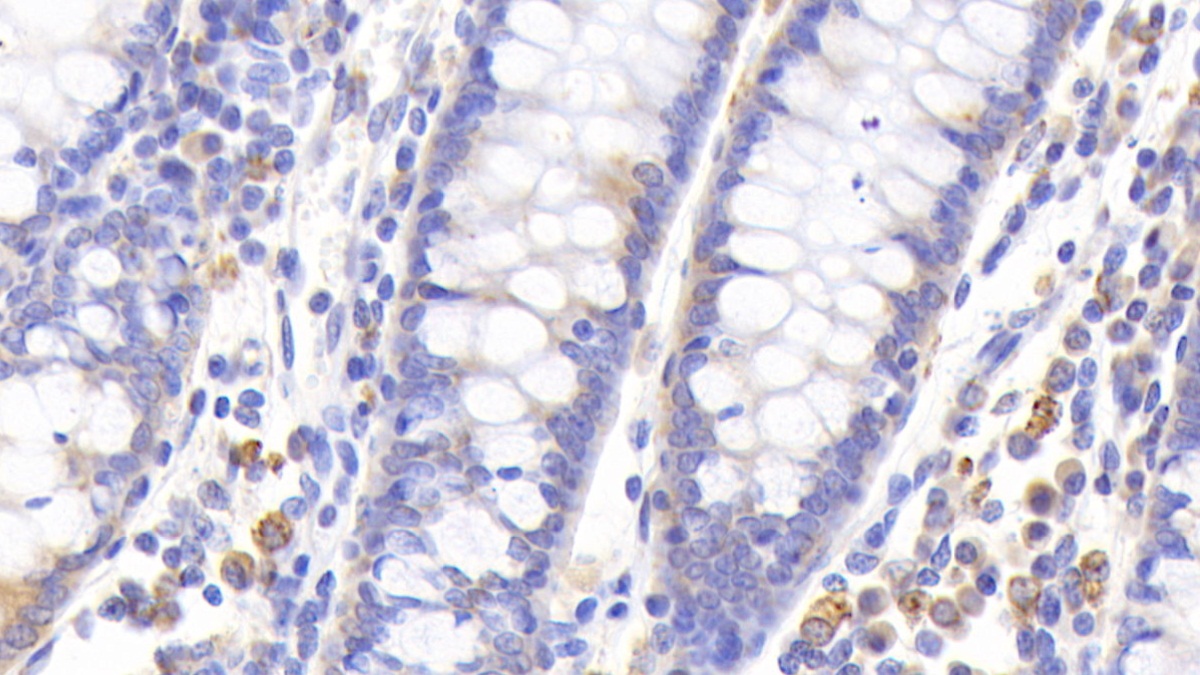 Polyclonal Antibody to Metallothionein 1 (MT1)