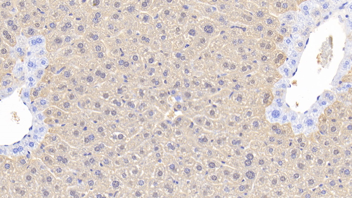 Polyclonal Antibody to Arginase (ARG)