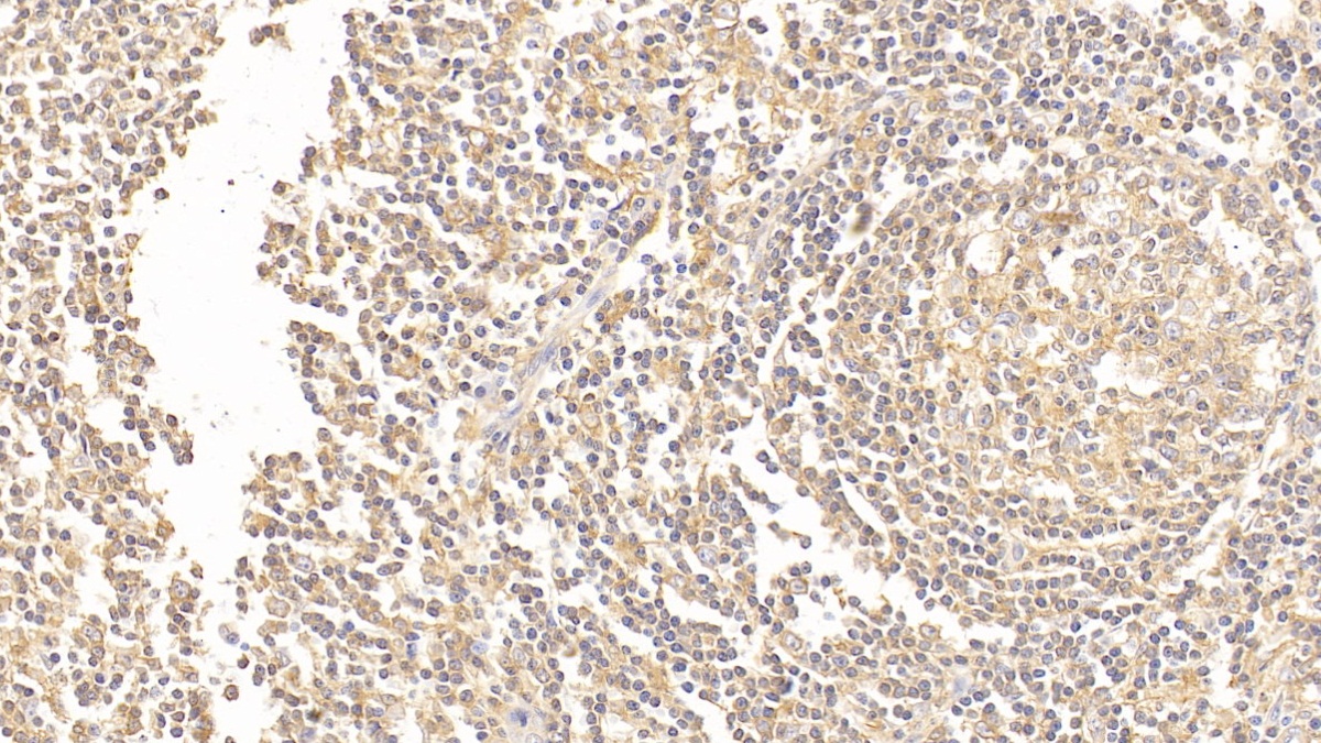 Polyclonal Antibody to Complement Receptor 1, Erythrocyte (CR1)