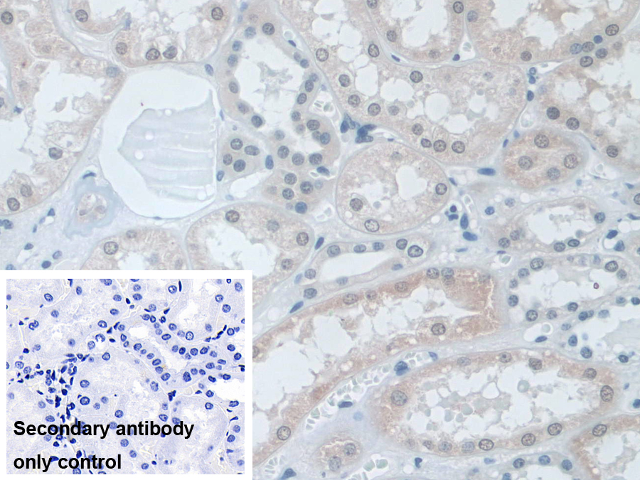 Polyclonal Antibody to Small Nuclear Ribonucleoprotein Polypeptide D1 (SNRPD1)