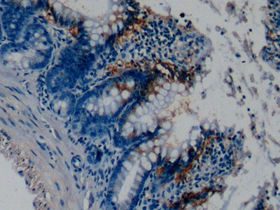 Polyclonal Antibody to Chondroitin Sulfate Proteoglycan 4 (CSPG4)