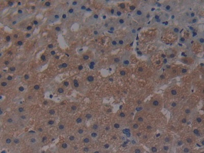 Polyclonal Antibody to Mitogen Activated Protein Kinase Kinase Kinase 1 (MAP3K1)