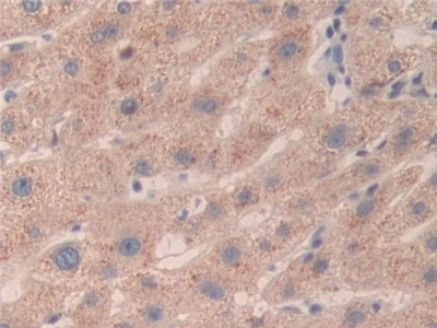 Polyclonal Antibody to Structural Maintenance Of Chromosomes Protein 3 (SMC3)