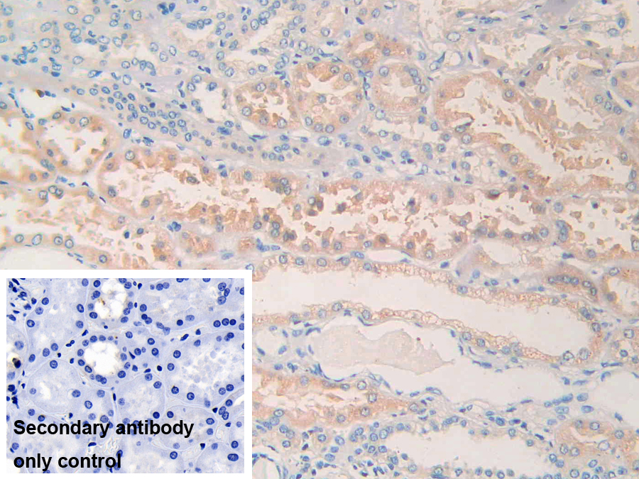 Polyclonal Antibody to Phospholipase A1 (PLA1)