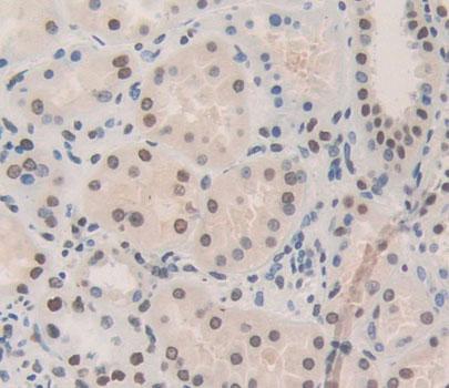 Polyclonal Antibody to Nucleoporin 133 (NUP133)