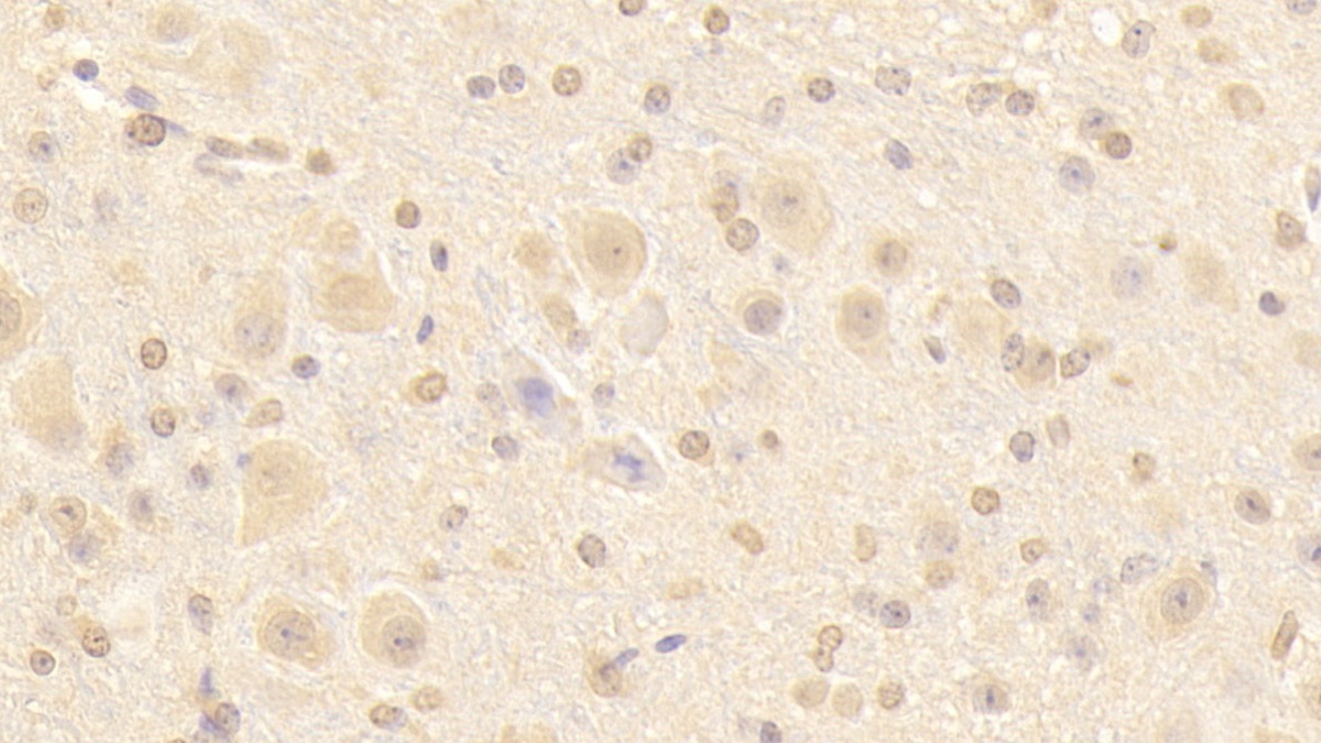 Polyclonal Antibody to Nucleoporin 133 (NUP133)