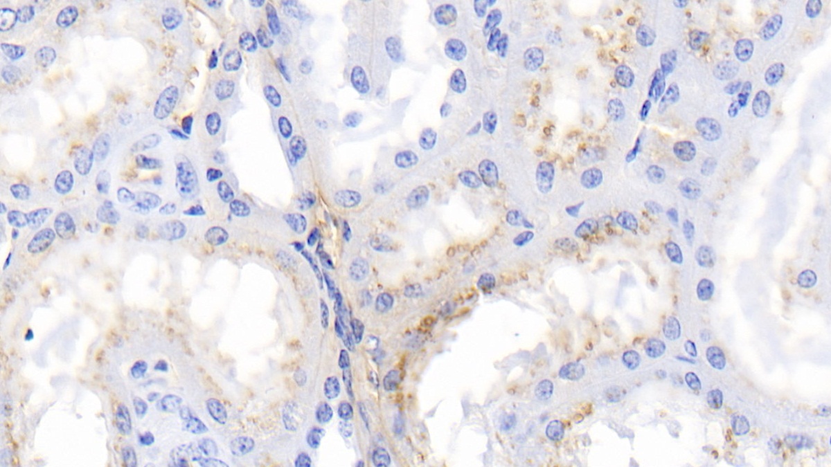 Polyclonal Antibody to Fibrinogen Alpha Chain (FGA)